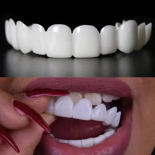 Venator™ Temporary Veneers